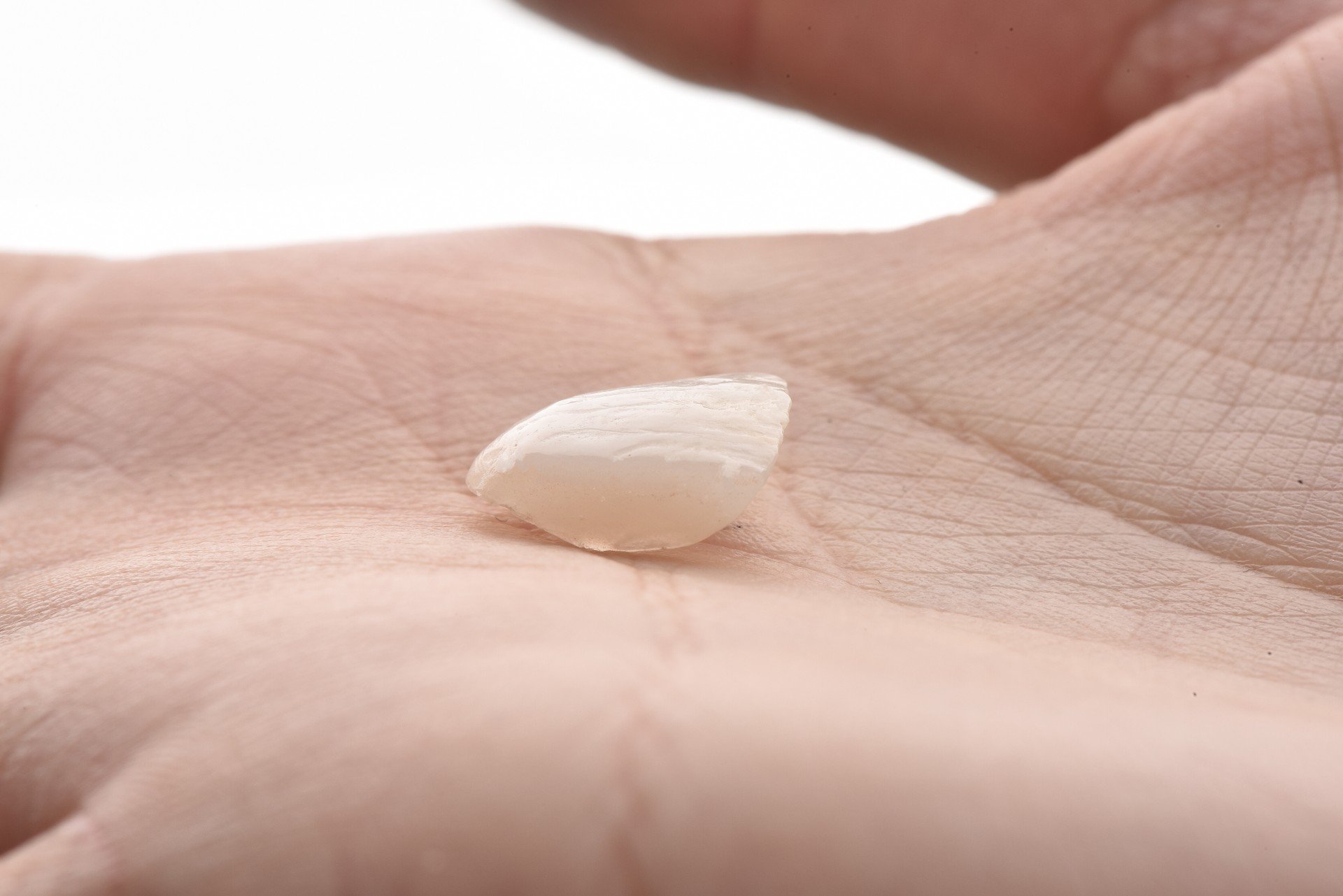 Faccette dentali: caratteristiche, vantaggi e applicazione