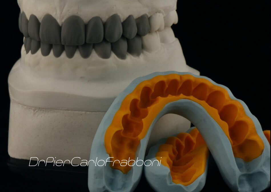 estetica dentale bologna - Duplicazione della Forma