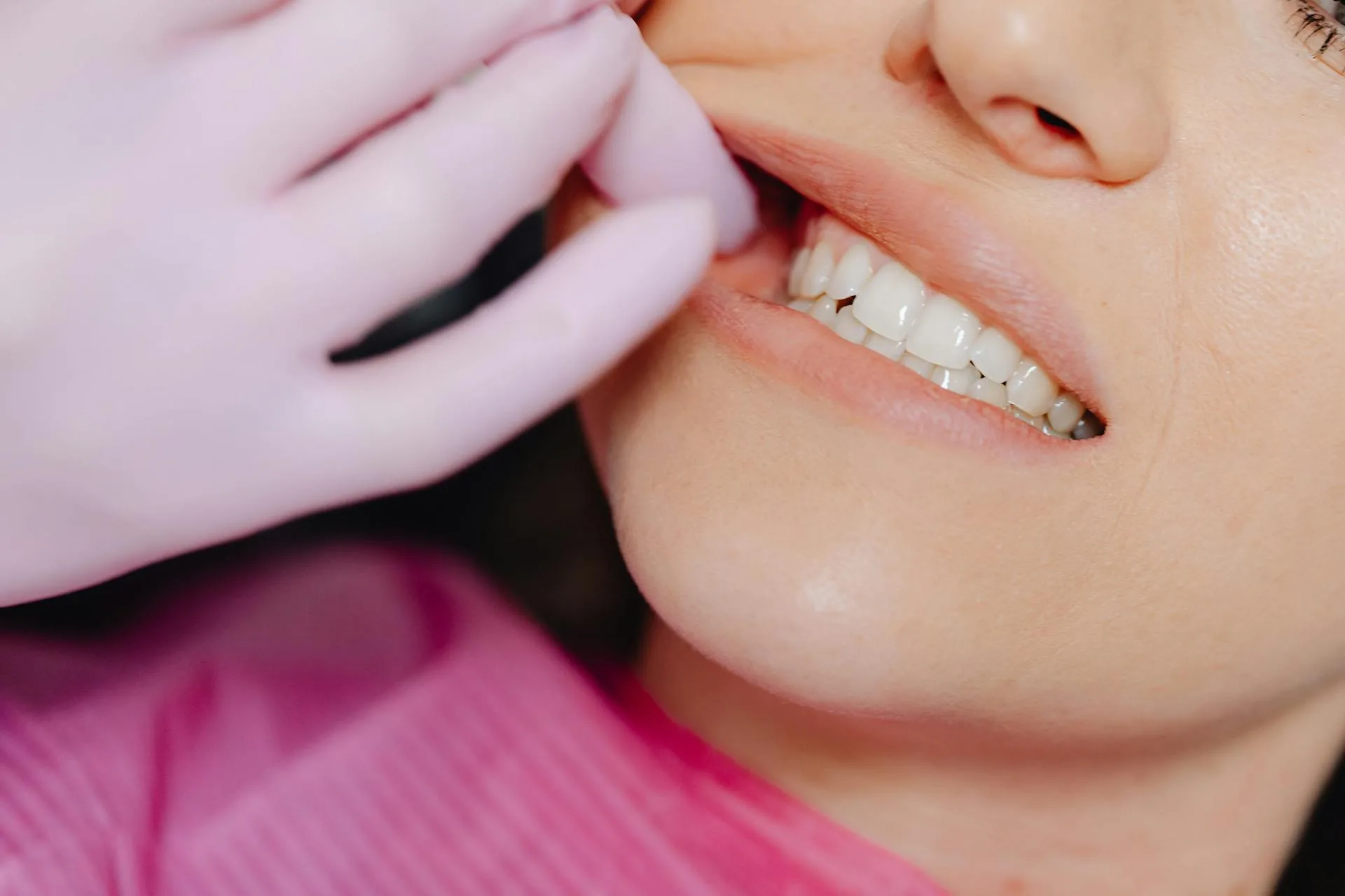 Sbiancamento Denti dal Dentista: Guida Completa al Trattamento Professionale